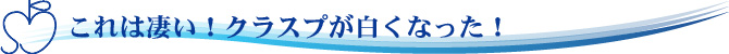 これは凄い！クラスプが白くなった！